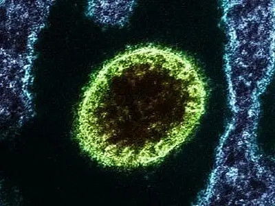 Vírus isolado Nipah observado em laboratório.