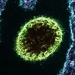 Ministério da Saúde emite alerta sobre o vírus Nipah após surto na Índia: entenda os riscos baixos para o Brasil e o que a população precisa saber em 2026